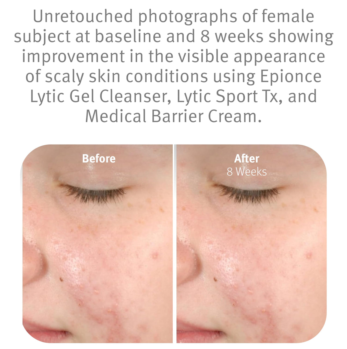 Epionce hand using cleanser demonstrating easy application benefit