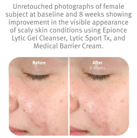 Epionce hand using cleanser demonstrating easy application benefit