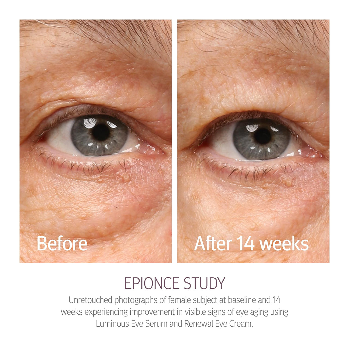 Epionce Renewal Eye Cream hyaluronic acid ingredient close-up shows hydration benefit