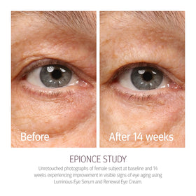 Epionce Renewal Eye Cream hyaluronic acid ingredient close-up shows hydration benefit