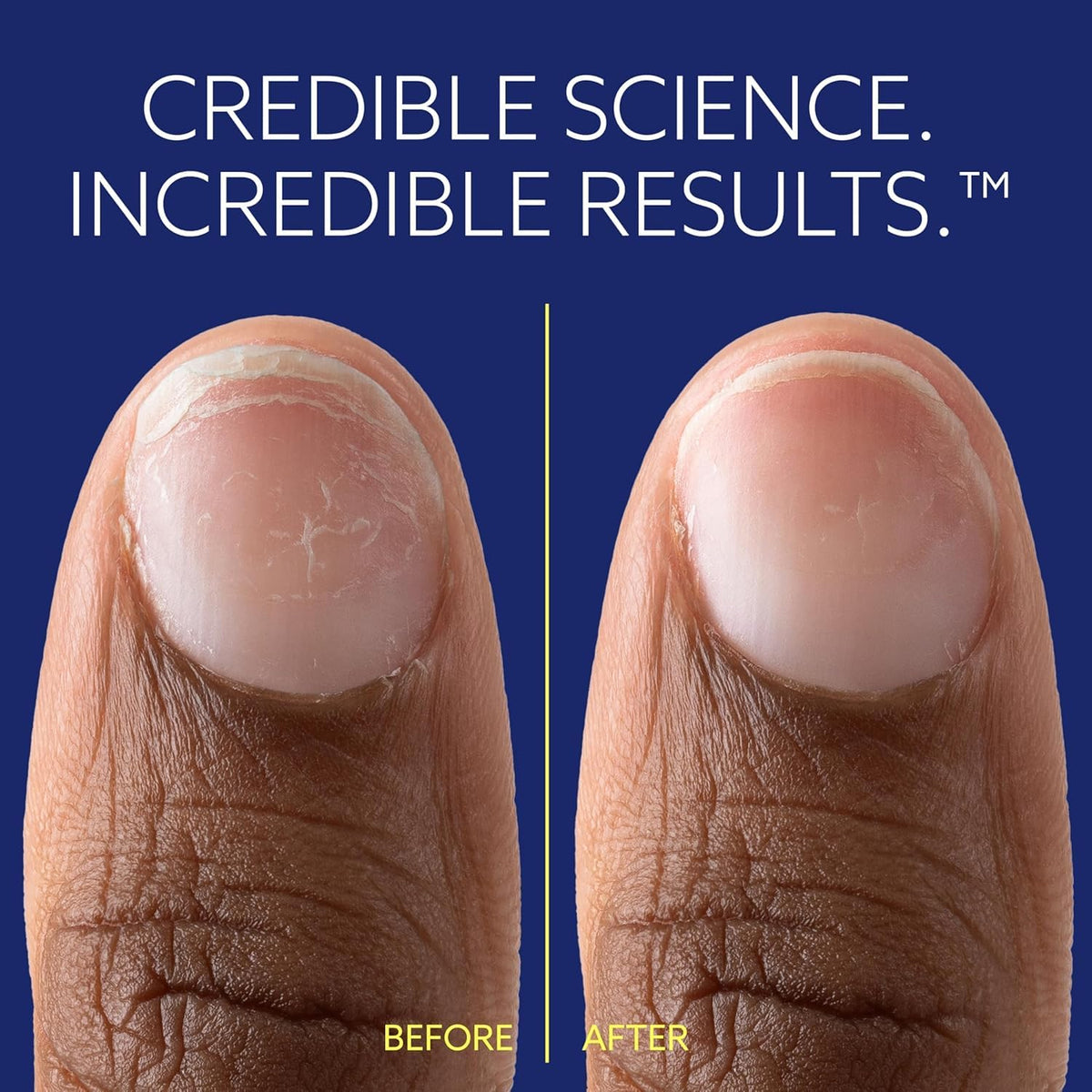 epres ePhD before and after nails showing stronger, smoother nails