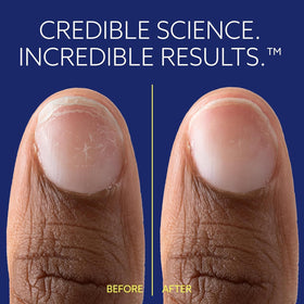 epres ePhD before and after nails showing stronger, smoother nails