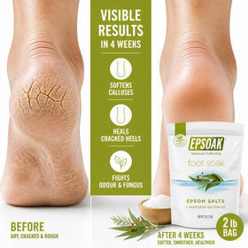 Epsoak salt poured into a basin during foot soak demonstrating soothing use