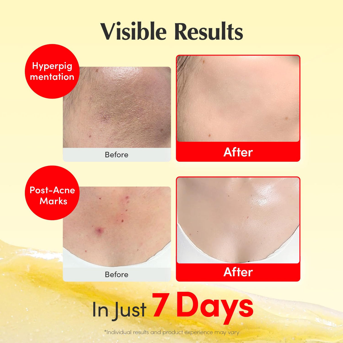 EQQUALBERRY acerola extract ingredient image highlighting antioxidant boost