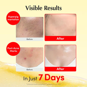 EQQUALBERRY acerola extract ingredient image highlighting antioxidant boost