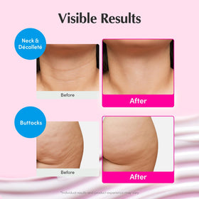 EQQUALBERRY cream being applied to neck demonstrating lifting and hydration