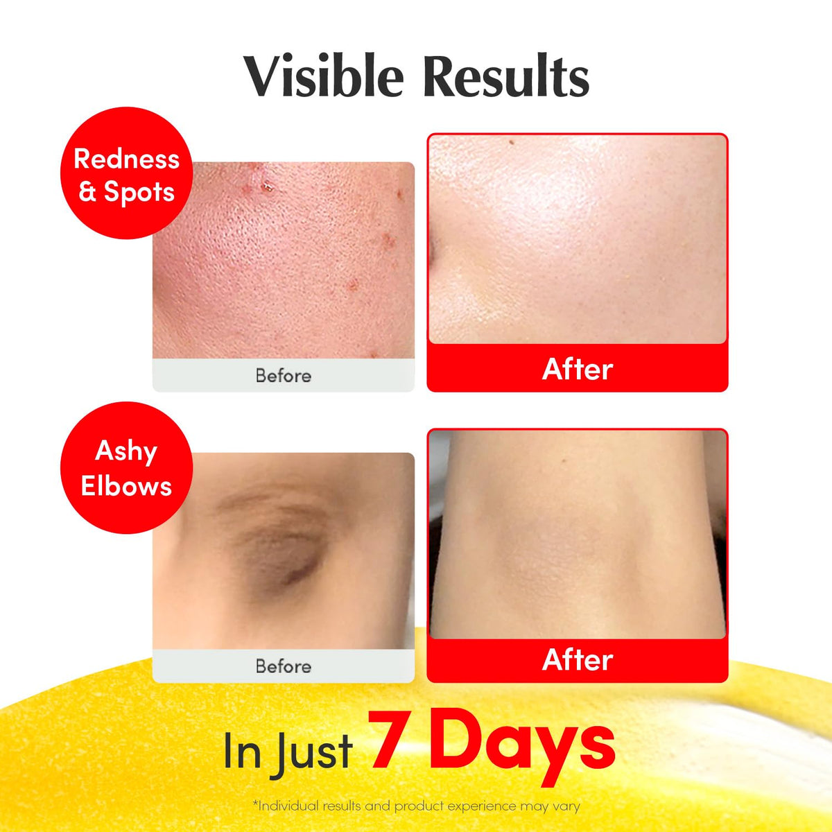 EQQUALBERRY serum applied to skin demonstrating dewy hydration and smoother appearance