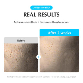 EQQUALBERRY toner applied on skin showing quick absorption and hydrated look
