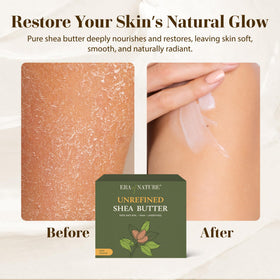 era of nature hands applying shea butter, fast skin moisturization
