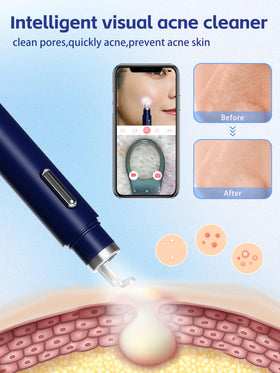EURART LED lights illuminating skin to improve visibility and accurate cleaning