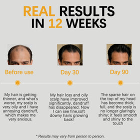 Excalvo illustrative before and after hair showing fuller appearance and thicker look