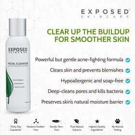 Exposed Skin Care placed on bathroom counter as part of routine