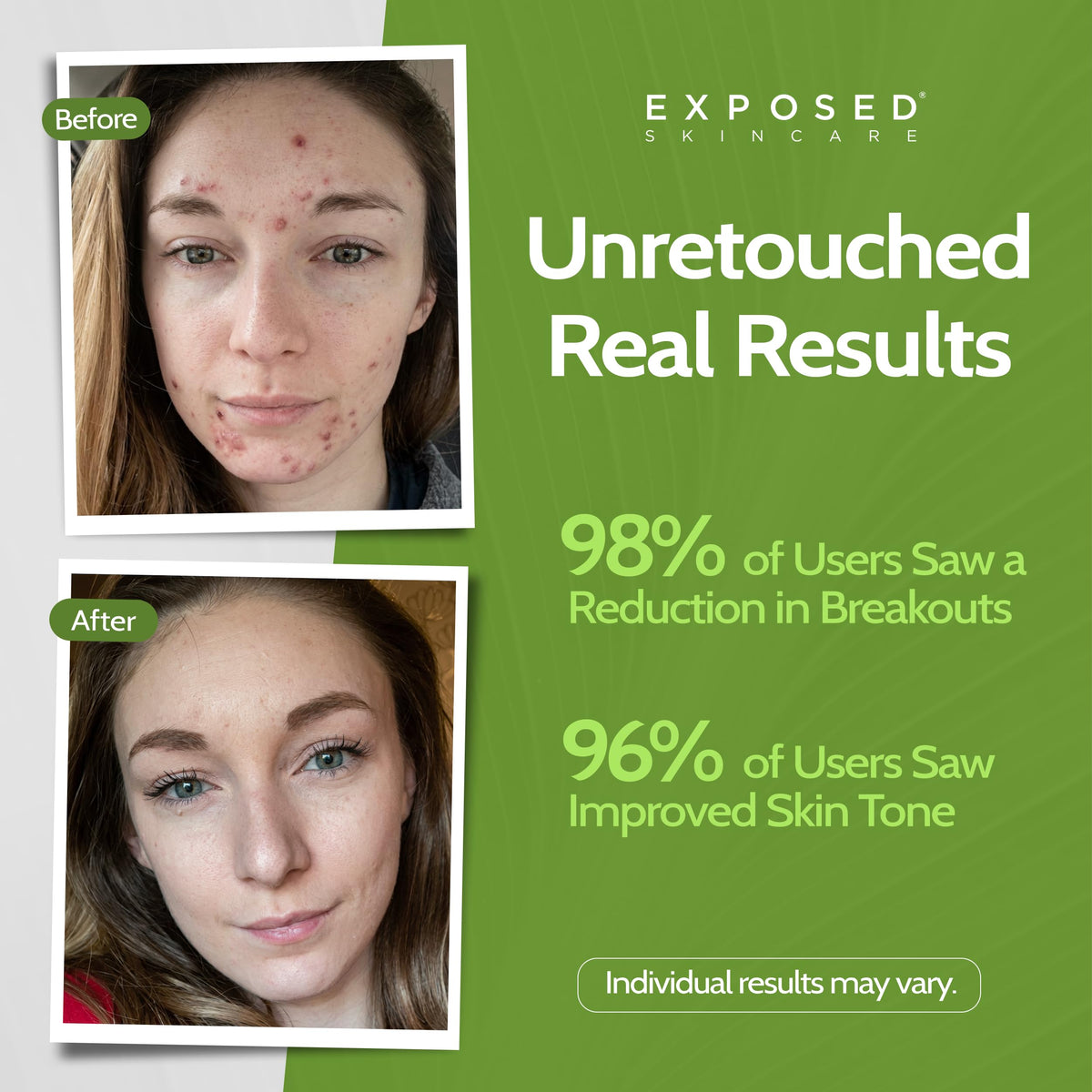 Exposed Skin Care creamy foam texture demonstrating gentle cleanse