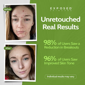 Exposed Skin Care creamy foam texture demonstrating gentle cleanse