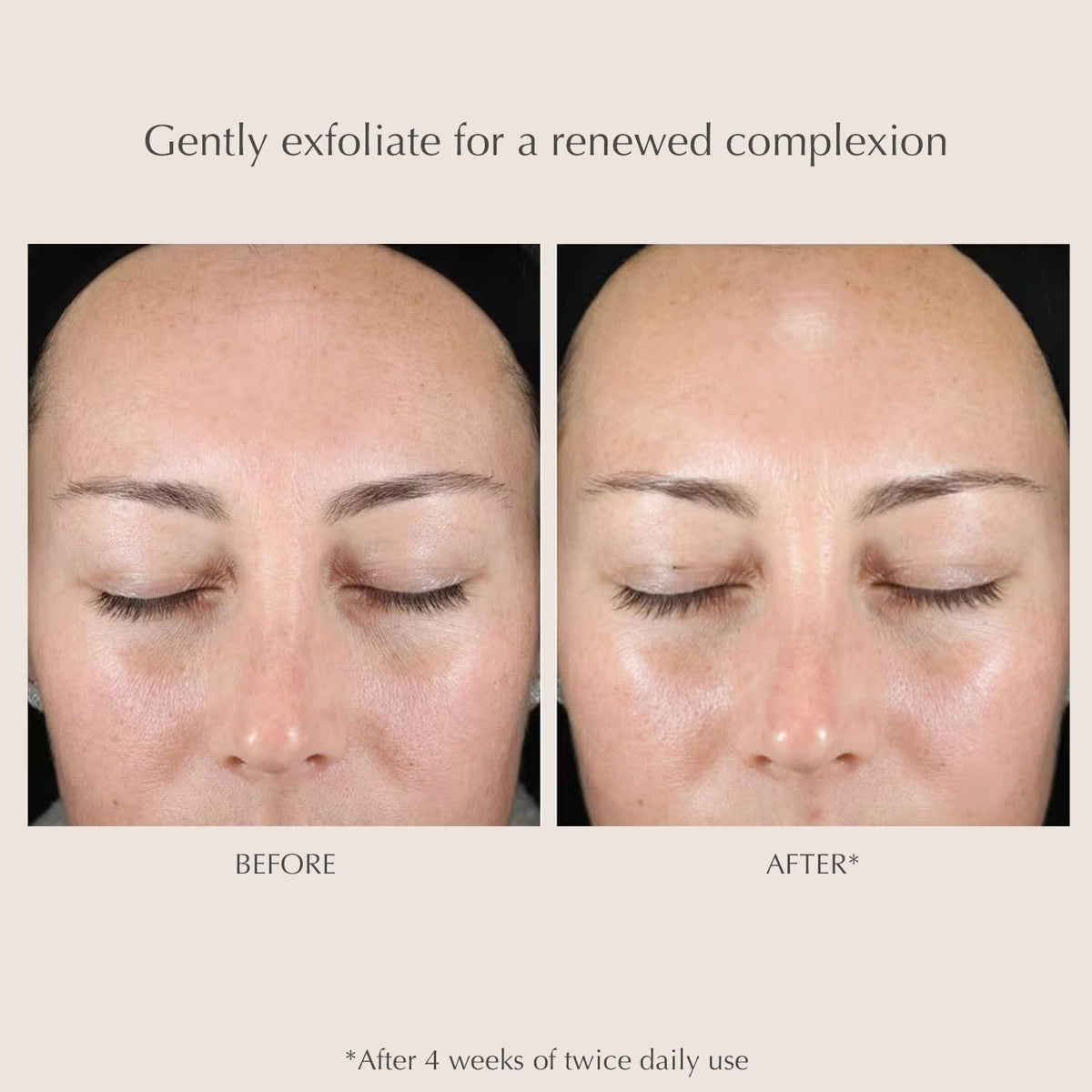 EXUVIANCE pad applied to cheek illustrating quick daily application