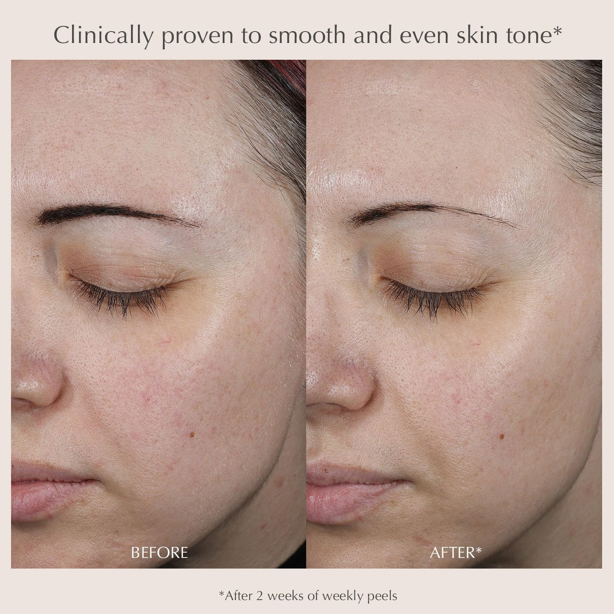 EXUVIANCE ingredients label highlighting glycolic mandelic benefits