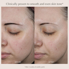 EXUVIANCE ingredients label highlighting glycolic mandelic benefits