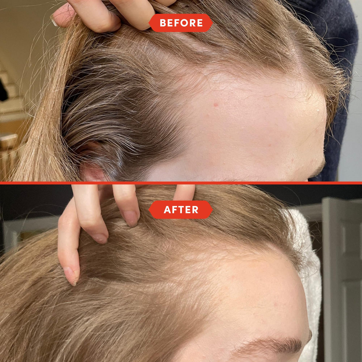 Fable & Mane scalp massage application demonstrating improved circulation