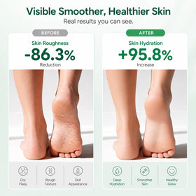 FAMIKYA before and after heel showing softening and visible improvement