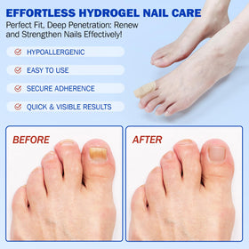 FANSHI patch on toe during sleep demonstrating overnight repair action