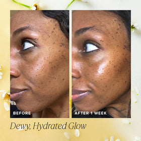 Farmacy application patting essence into skin for boosted absorption
