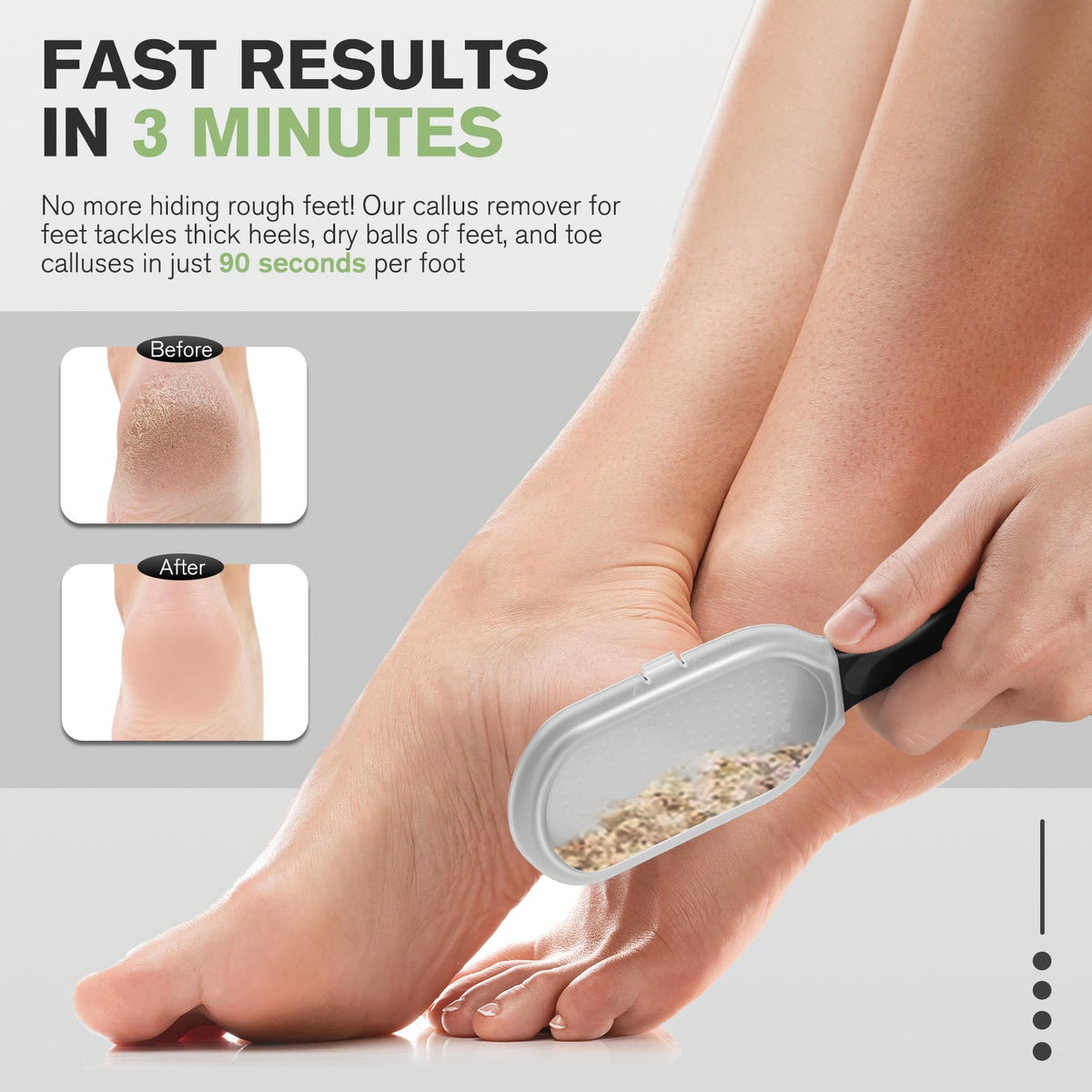 FERYES dead skin catcher detail containing trimmed skin for cleaner cleanup