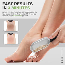 FERYES dead skin catcher detail containing trimmed skin for cleaner cleanup