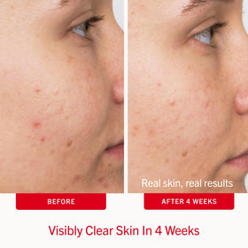 First Aid Beauty pad held in hand demonstrating easy, mess-free application
