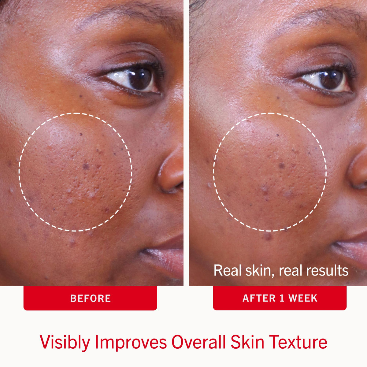 First Aid Beauty pad close-up texture showing soaked surface for consistent dosing