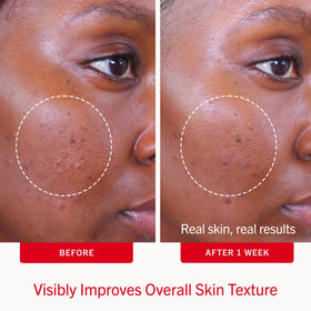 First Aid Beauty pad close-up texture showing soaked surface for consistent dosing