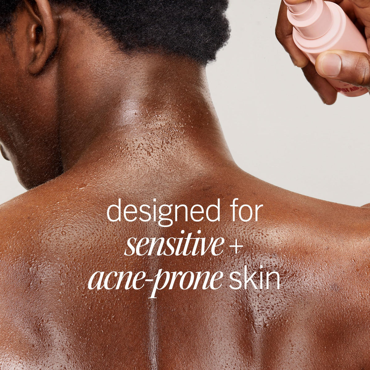 First Aid Beauty smoother back skin after two weeks showing texture improvement
