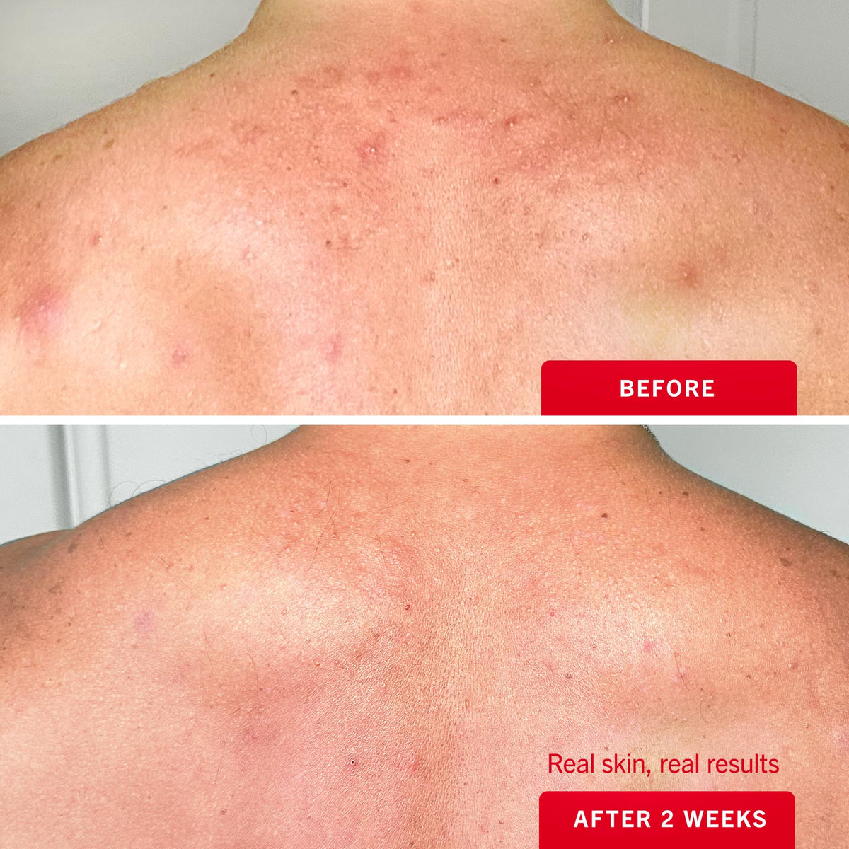 First Aid Beauty applying spray to back using a mirror for reach benefit