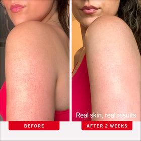 First Aid Beauty scrub being massaged onto arm in shower to smooth bumps