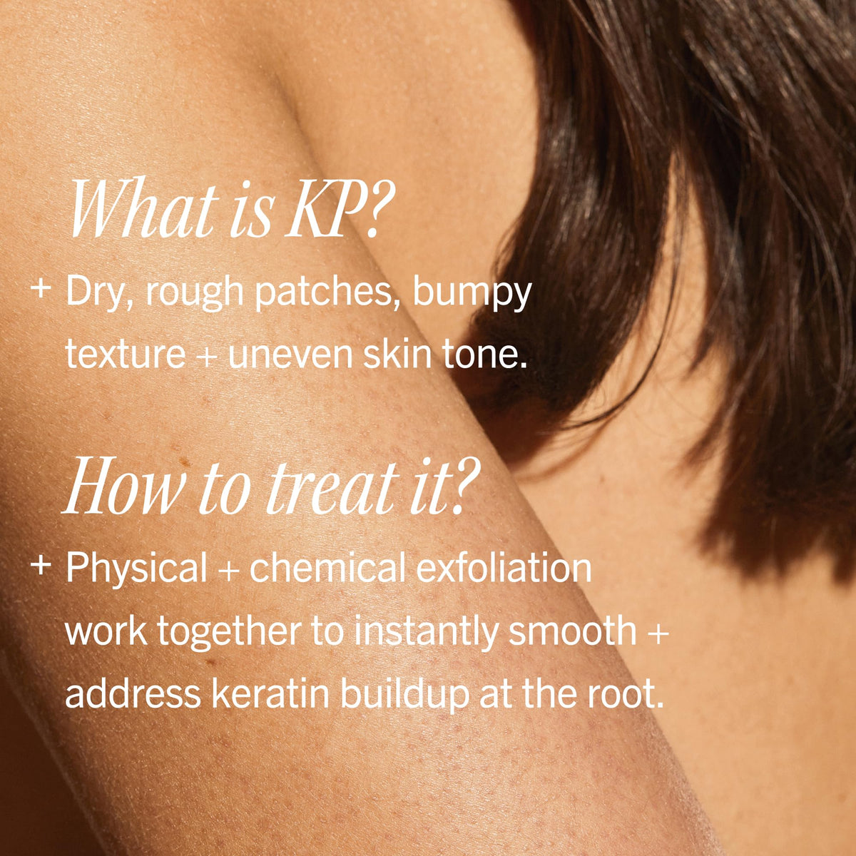 First Aid Beauty applied on arm before and after showing smoother texture