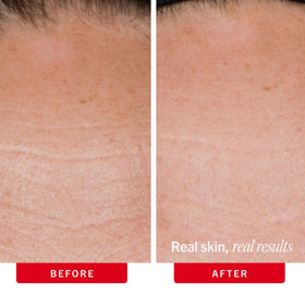 First Aid Beauty open jar top view revealing creamy consistency for easy scooping and layering