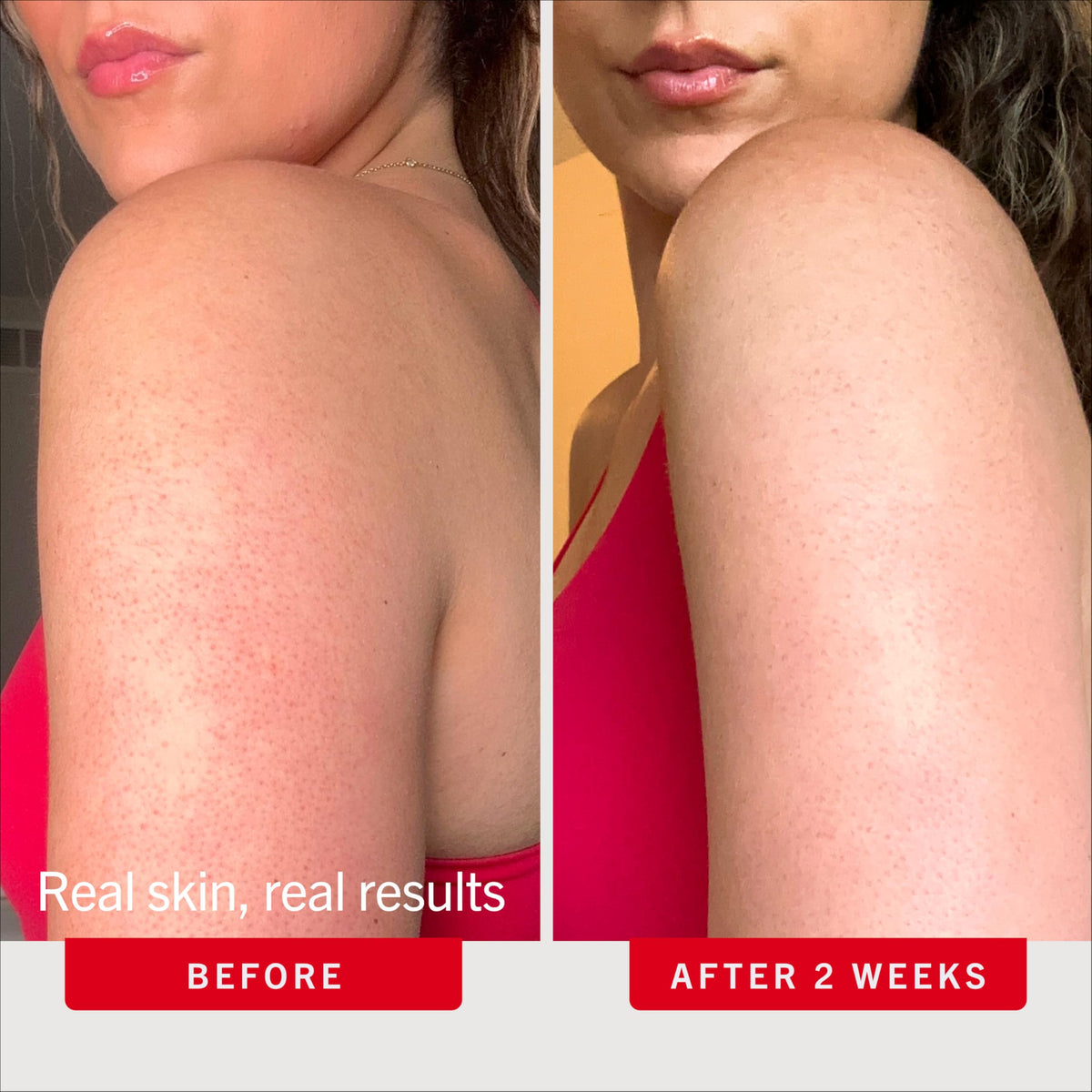First Aid Beauty ingredient visual with peach and botanical extracts for soothing