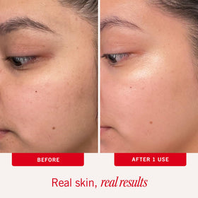 First Aid Beauty smooth pad close-up for gentle cleansing benefit