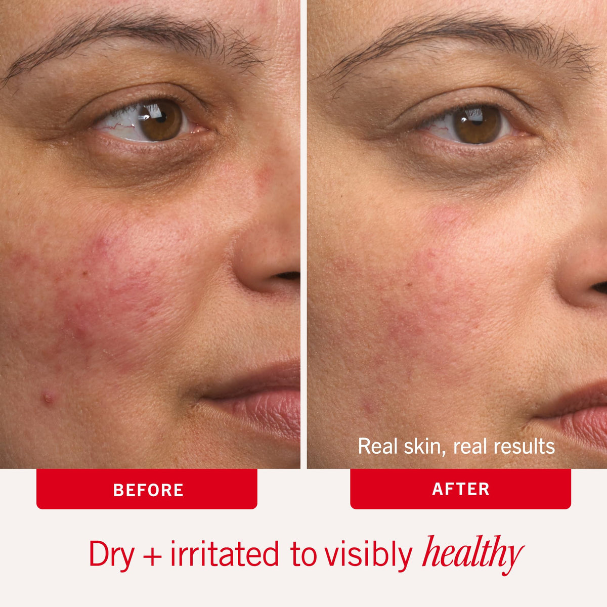 First Aid Beauty cream spread on hand demonstrating non-greasy hydration