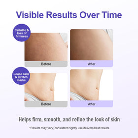 FIUMOT applying cream to thigh to show targeted use and smoothing benefit
