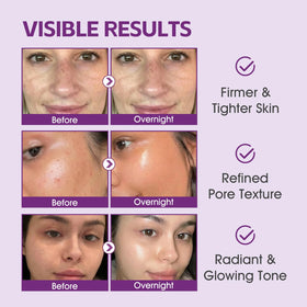 FIVECRAS silicone brush included for mess-free, even application and precise coverage