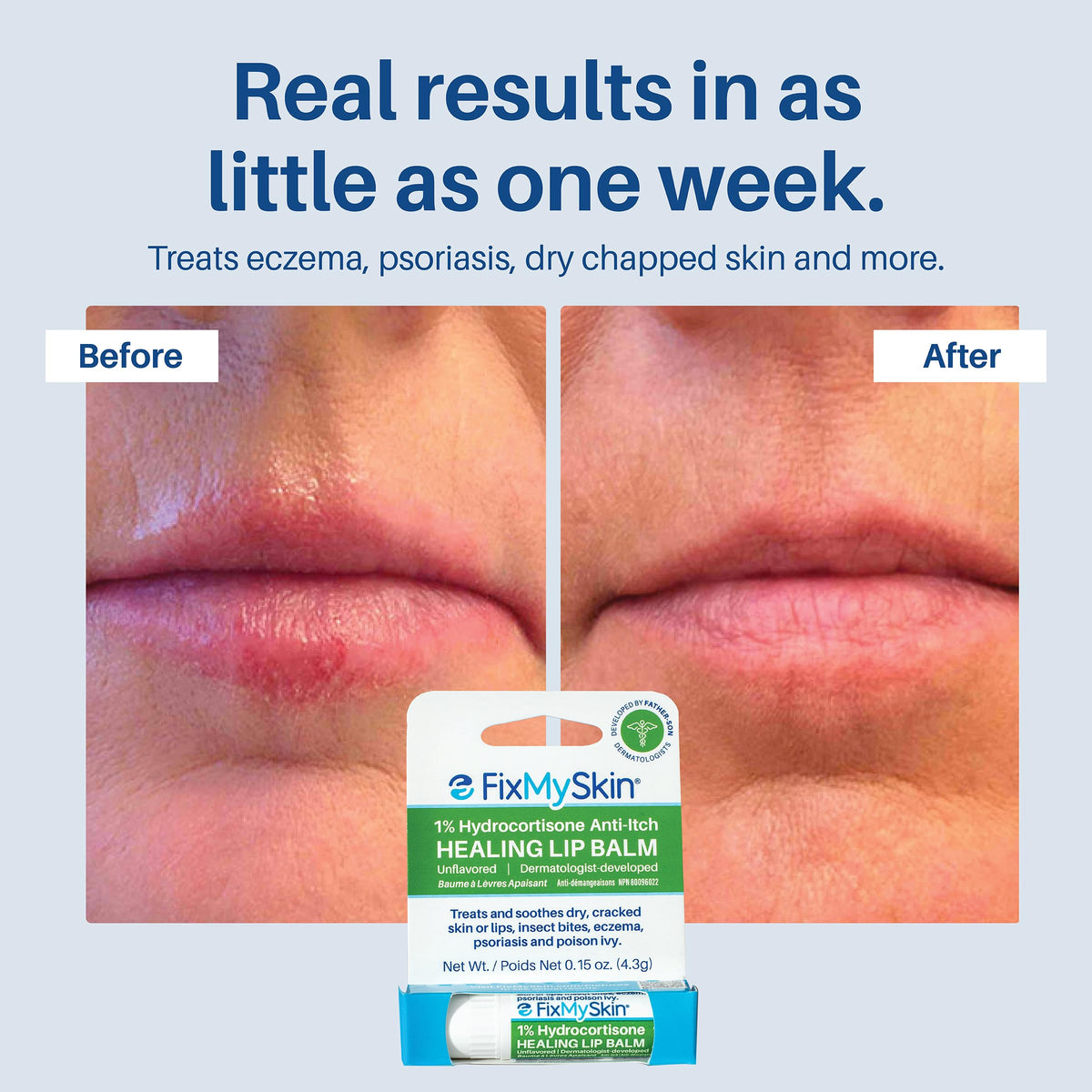 Open FixMySkin tube revealing firm balm stick and hygienic twist-up applicator