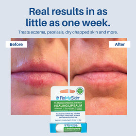 Open FixMySkin tube revealing firm balm stick and hygienic twist-up applicator