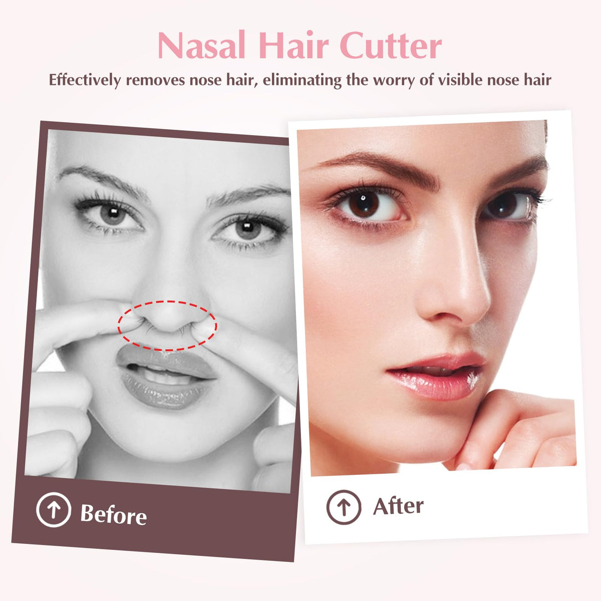 FLATRI in use demonstrating precise trimming without irritation