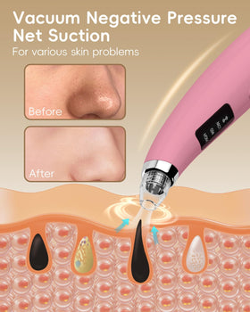 FLYMOOO five detachable heads laid out to show versatile attachments for targeted cleansing