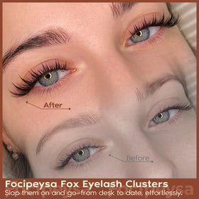 Focipeysa before and after comparison showing natural enhancement
