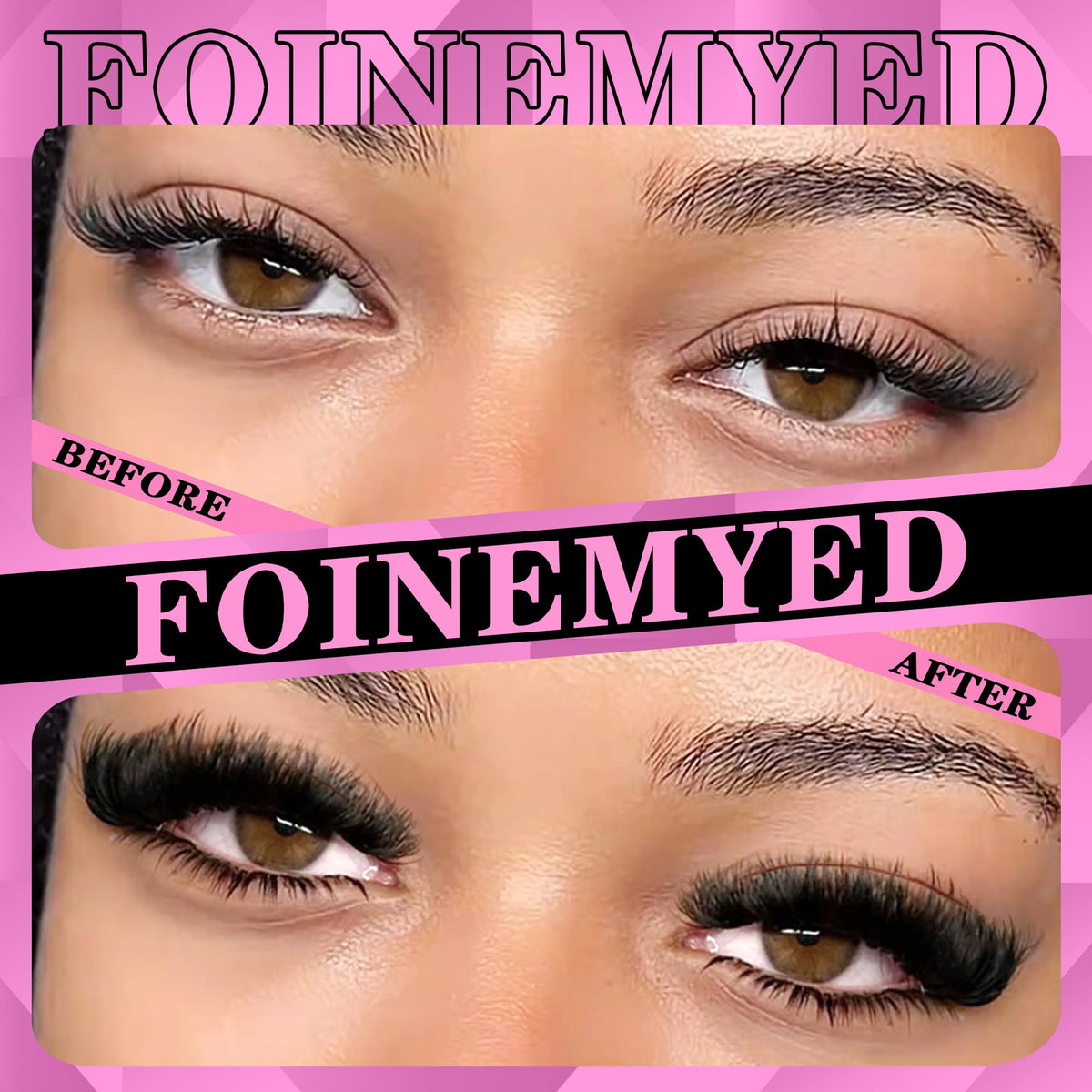 FOINEMYED tweezers and 10ml bond and seal included for precise application