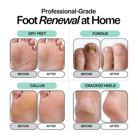 Close-up of Foot Choice Epsom salts and granules showing purity and therapeutic feel