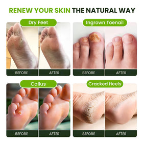 FOOT CURE foot basin soak in use to soothe tired feet