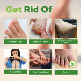 FOOT CURE ingredients arrangement with tea tree and eucalyptus for freshness