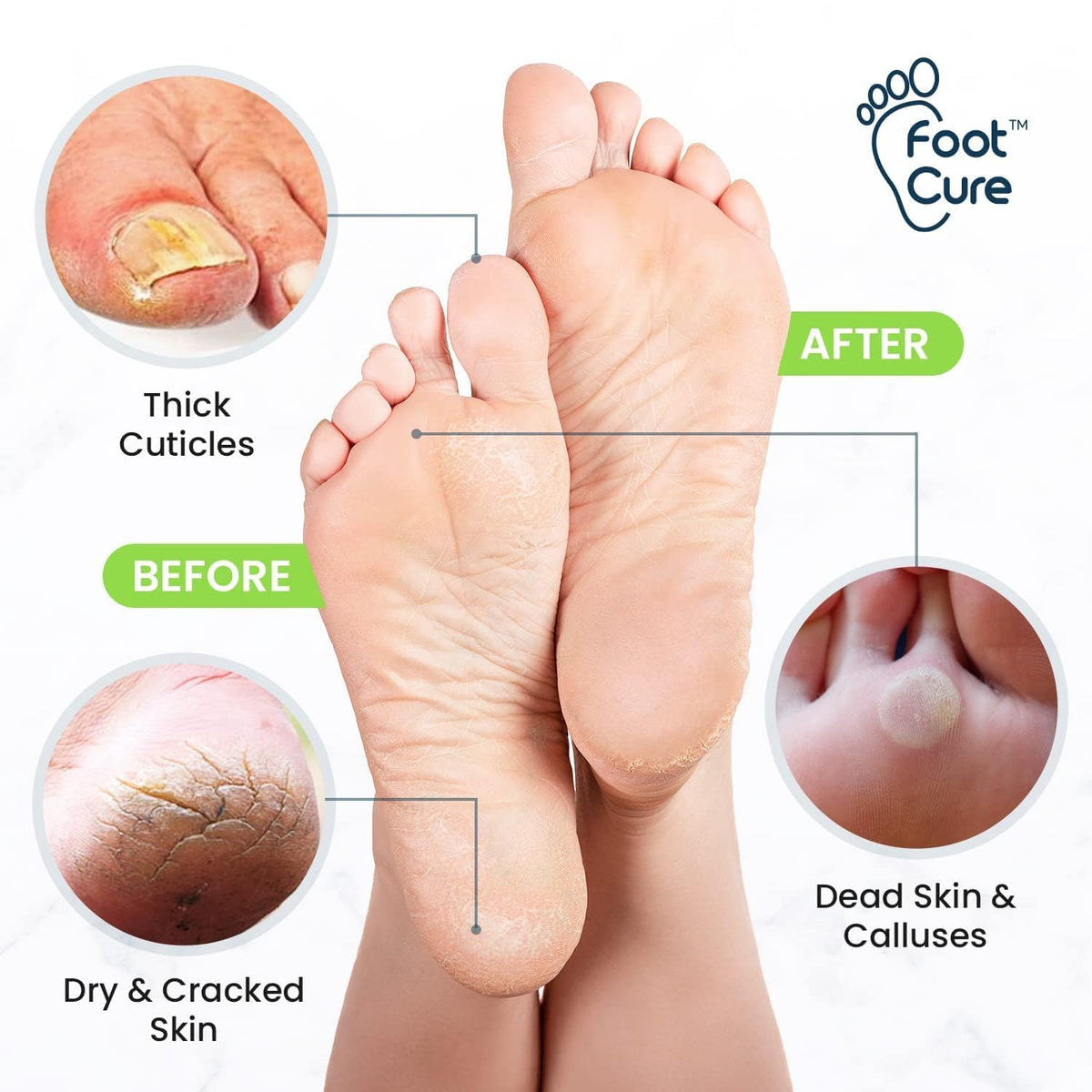 FOOT CURE ingredient list close-up showing essential oil blend